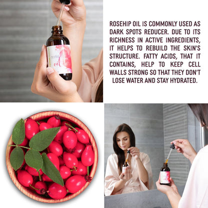 Organic Rosehip Seed Essentialoil - 4 Oz Pure Cold Pressed Unrefined Rose Hip Serum for Face Hair Nails 100% Natural Skin Care Moisturizerscar Removal & Facial Acne Treatment