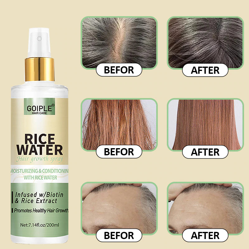 GOIPLE Big Size Rice Water Serum Spray for Thinning Loss Hair Care Growth Essence Yao Women of China Repair Damaged Regrowth Oil
